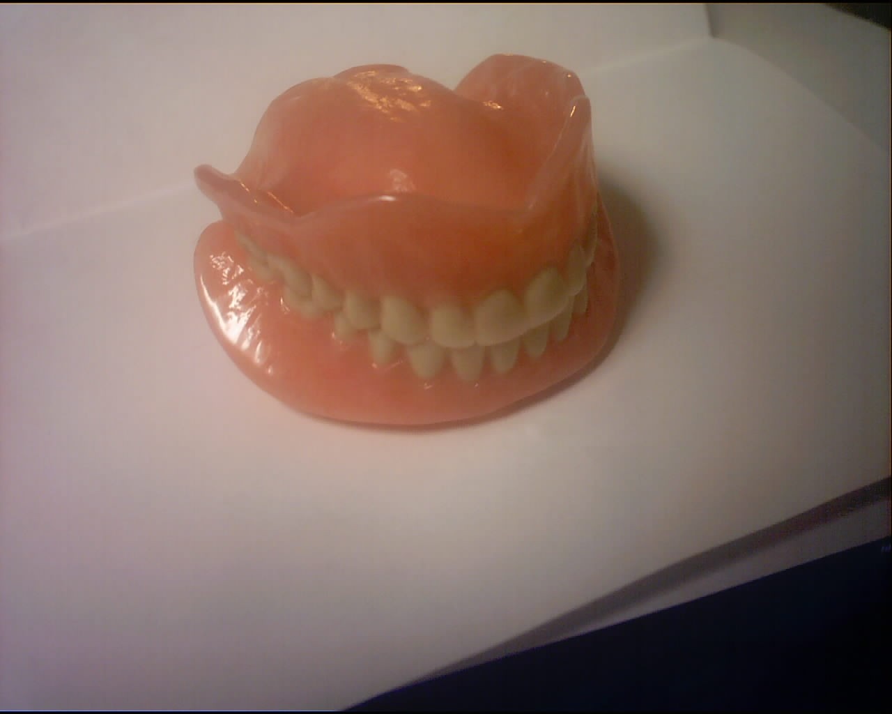 Dentures fabricated by Miles Dental Technics